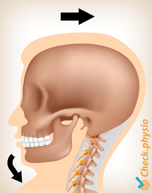 dolor de latigazo cervical movimiento 1