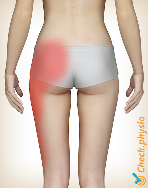 pelvis articulación sacroilíaca ubicación del dolor